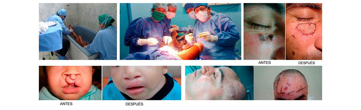 cirugia reconstructiva chiclayo